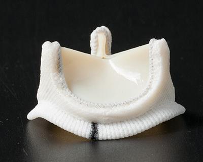 Two-Year Clinical Follow-Up Assessment of the Novel Cingular Surgical Bovine Pericardial Valve
